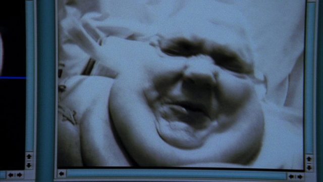 Dr. House S03E06