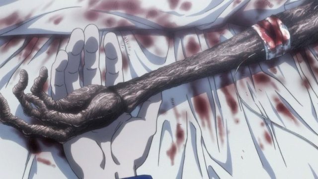 Hunter × Hunter S03E145