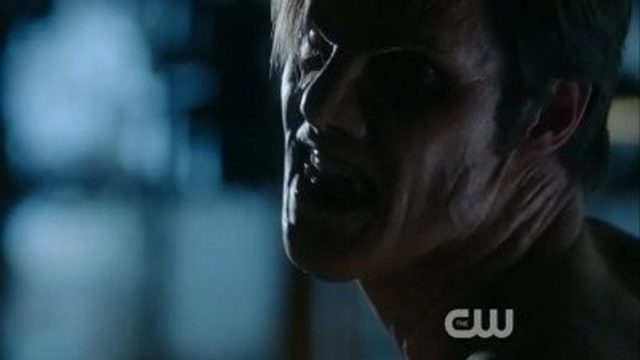 Bella y Bestia S01E15